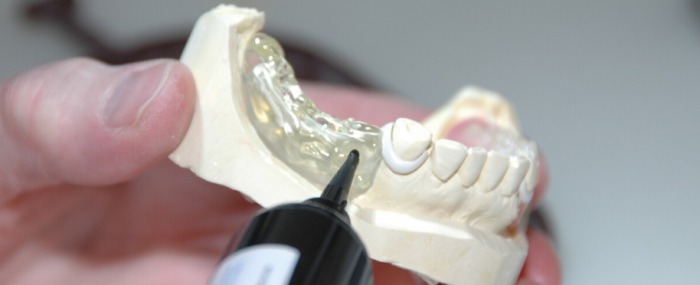 Prótese Dentária: Conheça a diferença entre a prótese total e o protocolo